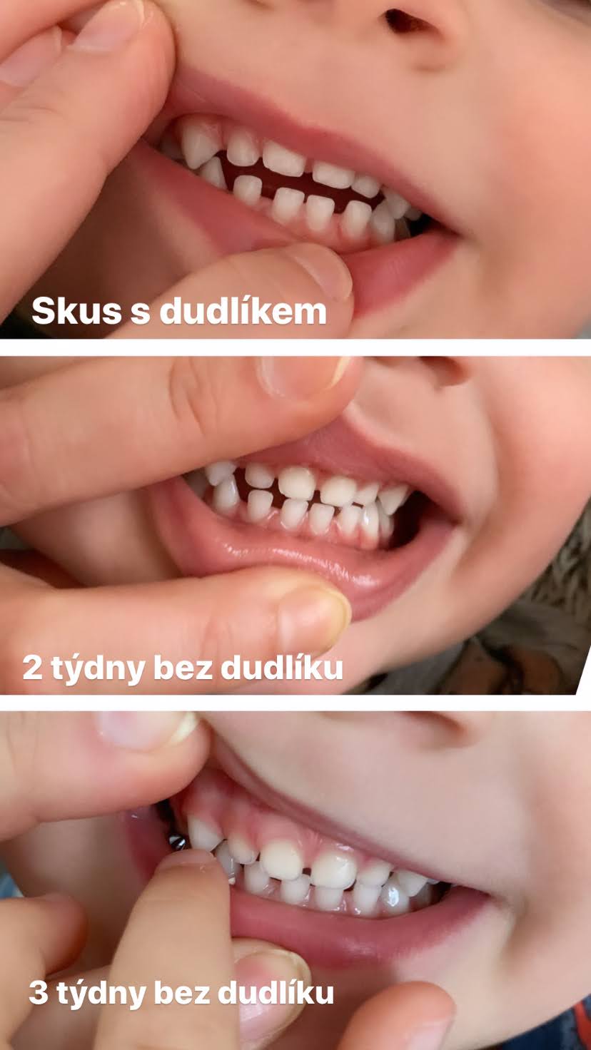 AAA7747A-C0EE-42E7-80B1-BB39E3E04E9A